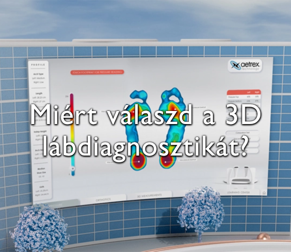 Aetrex lábdiagnosztika